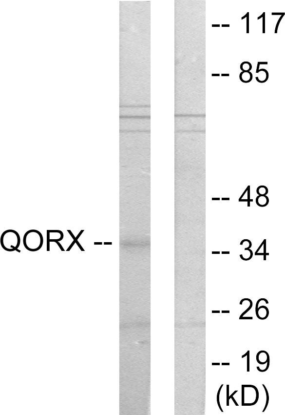 TP53I3 / PIG3 Antibody - Western blot analysis of lysates from 293 cells, using QORX Antibody. The lane on the right is blocked with the synthesized peptide.