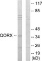 TP53I3 / PIG3 Antibody - Western blot analysis of lysates from 293 cells, using QORX Antibody. The lane on the right is blocked with the synthesized peptide.