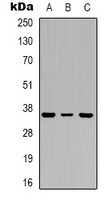 TP53I3 / PIG3 Antibody - Western blot analysis of PIG3 expression in A549 (A); MCF7 (B); HepG2 (C) whole cell lysates.
