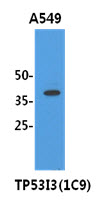 TP53I3 / PIG3 Antibody - Western Blot: The cell lysates (40 ug) were resolved by SDS-PAGE, transferred to PVDF membrane and probed with anti-human TP53I3 antibody (1:3000). Proteins were visualized using a goat anti-mouse secondary antibody conjugated to HRP and an ECL detection system.