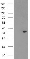 TP53I3 / PIG3 Antibody - HEK293T cells were transfected with the pCMV6-ENTRY control (Left lane) or pCMV6-ENTRY TP53I3 (Right lane) cDNA for 48 hrs and lysed. Equivalent amounts of cell lysates (5 ug per lane) were separated by SDS-PAGE and immunoblotted with anti-TP53I3.