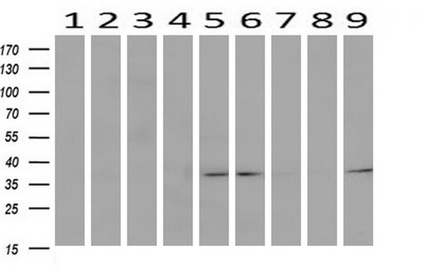 TP53I3 / PIG3 Antibody - Western blot of extracts (10ug) from 9 Human tissue by using anti-TP53I3 monoclonal antibody at 1:200 (1: Testis; 2: Omentum; 3: Uterus; 4: Breast; 5: Brain; 6: Liver; 7: Ovary; 8: Thyroid gland; 9: colon).