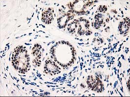TP53I3 / PIG3 Antibody - IHC of paraffin-embedded Human breast tissue using anti-TP53I3 mouse monoclonal antibody. (Heat-induced epitope retrieval by 10mM citric buffer, pH6.0, 100C for 10min).