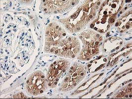 TP53I3 / PIG3 Antibody - IHC of paraffin-embedded Human Kidney tissue using anti-TP53I3 mouse monoclonal antibody. (Heat-induced epitope retrieval by 10mM citric buffer, pH6.0, 100C for 10min).