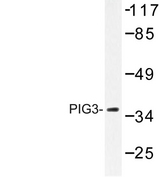 TP53I3 / PIG3 Antibody - Western blot of PIG3 (L265) pAb in extracts from 293 cells.