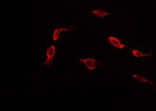TP53I3 / PIG3 Antibody - Staining 293 cells by IF/ICC. The samples were fixed with PFA and permeabilized in 0.1% Triton X-100, then blocked in 10% serum for 45 min at 25°C. The primary antibody was diluted at 1:200 and incubated with the sample for 1 hour at 37°C. An Alexa Fluor 594 conjugated goat anti-rabbit IgG (H+L) Ab, diluted at 1/600, was used as the secondary antibody.
