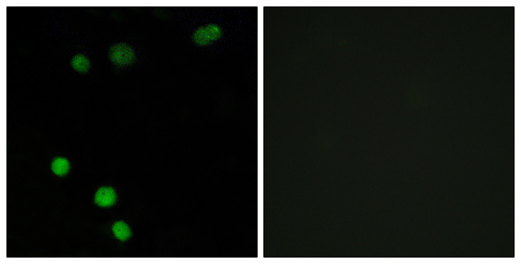 TP53INP2 Antibody - Immunofluorescence analysis of MCF7 cells, using TP53INP2 Antibody. The picture on the right is blocked with the synthesized peptide.