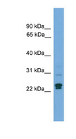 TP53INP2 Antibody - TP53INP2 antibody Western blot of Fetal Heart lysate. This image was taken for the unconjugated form of this product. Other forms have not been tested.