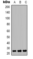 TP53INP2 Antibody - Western blot analysis of TP53INP2 expression in SHSY5Y (A); HEK293T (B); mouse kidney (C) whole cell lysates.