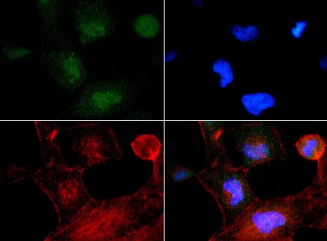 TP53INP2 Antibody - Immunocytochemistry/Immunofluorescence: TP53INP2 Antibody - TP53INP2 antibody was tested at 1:200 in HeLa cells with FITC (green). Nuclei and actin were counterstained with Dapi (blue) and Phalloidin (red).  This image was taken for the unconjugated form of this product. Other forms have not been tested.