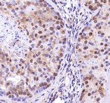 TP53INP2 Antibody - Immunohistochemistry: TP53INP2 Antibody - Staining of TP53INP2 in mouse prostate.  This image was taken for the unconjugated form of this product. Other forms have not been tested.