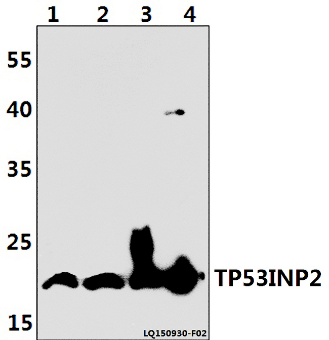 TP53INP2 Antibody - Western blot of TP53INP2 antibody at 1:500 dilution. Lane 1: PC12 whole cell lysate (40 ug). Lane 2: NIH-3T3 whole cell lysate (40 ug). Lane 3: HEK293T whole cell lysate (40 ug). Lane 4: RAW264.7 whole cell lysate (40 ug).