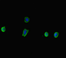 TP53INP2 Antibody - Immunofluorescent analysis of MCF7 cells diluted at 1:100 and Alexa Fluor 488-congugated AffiniPure Goat Anti-Rabbit IgG(H+L)