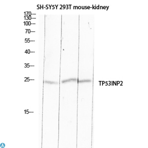 TP53INP2 Antibody - Western Blot (WB) analysis of SH-SY5Y 293T Mouse Kidney lysis using TP53INP2 antibody.