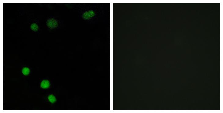 TP53INP2 Antibody - Peptide - + Immunofluorescence analysis of MCF-7 cells, using TP53INP2 antibody.