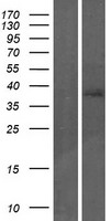 TP53INP2 Protein - Western validation with an anti-DDK antibody * L: Control HEK293 lysate R: Over-expression lysate