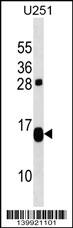 TP53TG1 Antibody - TP53TG1 Antibody (N-term) western blot analysis in U251 cell line lysates (35ug/lane).This demonstrates the TP53TG1 antibody detected the TP53TG1 protein (arrow).