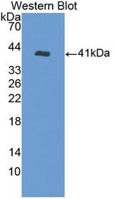 TP53TG5 Antibody - Western blot of TP53TG5 antibody.