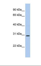TP53TG5 Antibody - 721_B cell lysate. Antibody concentration: 1.0 ug/ml. Gel concentration: 12%.  This image was taken for the unconjugated form of this product. Other forms have not been tested.