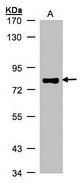 TP63 / p63 Antibody - Sample (30 ug whole cell lysate). A: A431. 7.5% SDS PAGE. TP63 / p63 antibody diluted at 1:500