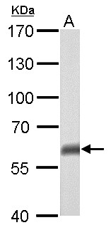 TP63 / p63 Antibody - p63 antibody [N2C1], Internal detects TP63 protein by Western blot analysis. A. 50 ug mouse brain lysate/extract. 7.5 % SDS-PAGE. p63 antibody [N2C1], Internal dilution:1:500