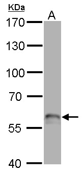 TP63 / p63 Antibody - p63 antibody [N2C1], Internal detects TP63 protein by Western blot analysis. A. 50 ug rat brain lysate/extract. 7.5 % SDS-PAGE. p63 antibody [N2C1], Internal dilution:1:500