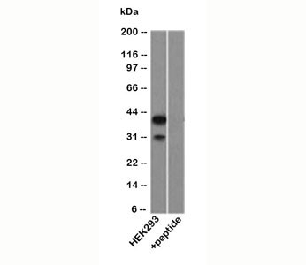TP63 / p63 Antibody - p40 p63 delta antibody western blot