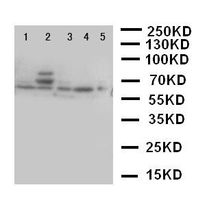 TP63 / p63 Antibody - WB of TP63 / p63 antibody. Lane 1: HELA Cell Lysate. Lane 2: SMMC Cell Lysate. Lane 3: COLO320 Cell Lysate. Lane 4: A549 Cell Lysate. Lane 5: SGC Cell Lysate..