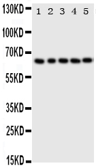 TP63 / p63 Antibody - Anti-p63 antibody, Western blotting Lane 1: HELA Cell LysateLane 2: SMMC Cell LysateLane 3: COLO320 Cell LysateLane 4: A549 Cell LysateLane 5: SGC Cell Lysate