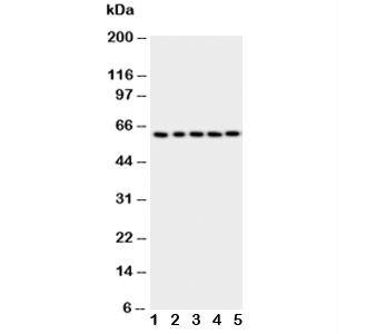 TP63 / p63 Antibody - Western blot testing of p63 antibody; Lane 1: HeLa; 2: SMMC-7721; 3: COLO320; 4: A549; 5: SGC cell lysate