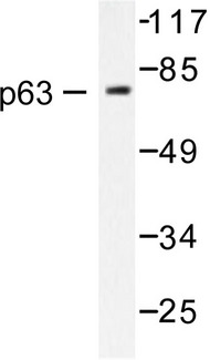 TP63 / p63 Antibody - Western blot (WB) analysis of p63 (N662) pAb in extracts from COS7 cells.