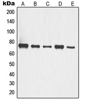 TP63 / p63 Antibody - Western blot analysis of p63 expression in A549 (A); HCT116 (B); COLO205 (C); LOVO (D); HT29 (E) whole cell lysates.