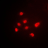 TP63 / p63 Antibody - Immunofluorescent analysis of p63 staining in A549 cells. Formalin-fixed cells were permeabilized with 0.1% Triton X-100 in TBS for 5-10 minutes and blocked with 3% BSA-PBS for 30 minutes at room temperature. Cells were probed with the primary antibody in 3% BSA-PBS and incubated overnight at 4 C in a humidified chamber. Cells were washed with PBST and incubated with a DyLight 594-conjugated secondary antibody (red) in PBS at room temperature in the dark. DAPI was used to stain the cell nuclei (blue).