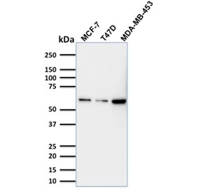 TP63 / p63 Antibody - Western blot testing of human MCF-7, T-47D and MDA-MB-453 lysate with p63 antibody (clone TP63/1786). Expected molecular weight: 63-77 kDa.