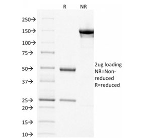 TP63 / p63 Antibody - SDS-PAGE analysis of purified, BSA-free p63 antibody (clone TP63/1786) as confirmation of integrity and purity.