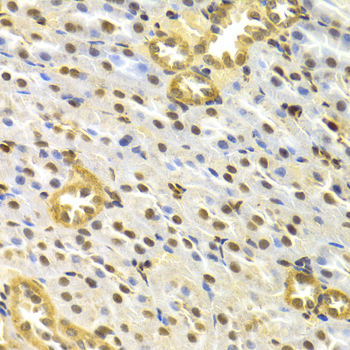 TP63 / p63 Antibody - Immunohistochemistry of paraffin-embedded rat kidney tissue.