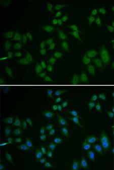 TP63 / p63 Antibody - Immunofluorescence analysis of U2OS cells.