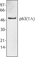 TP63 / p63 Antibody - Hela cell extract was resolved by electrophoresis, transferred to nitrocellulose, and probed with rabbit anti-p63(TA) antibody. Proteins were visualized using a donkey anti-rabbit secondary conjugated to HRP and a chemiluminescence detection system.
