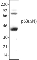 TP63 / p63 Antibody - Hela cell extract was resolved by electrophoresis, transferred to nitrocellulose, and probed with rabbit anti-p63(DN) antibody. Proteins were visualized using a donkey anti-rabbit secondary conjugated to HRP and a chemiluminescence detection system.