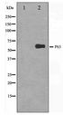 TP63 / p63 Antibody - Western blot of HeLa cell lysate using p63 Antibody