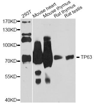 TP63 / p63 Antibody - Western blot analysis of extracts of various cell lines, using TP63 antibody at 1:3000 dilution. The secondary antibody used was an HRP Goat Anti-Rabbit IgG (H+L) at 1:10000 dilution. Lysates were loaded 25ug per lane and 3% nonfat dry milk in TBST was used for blocking. An ECL Kit was used for detection and the exposure time was 30s.