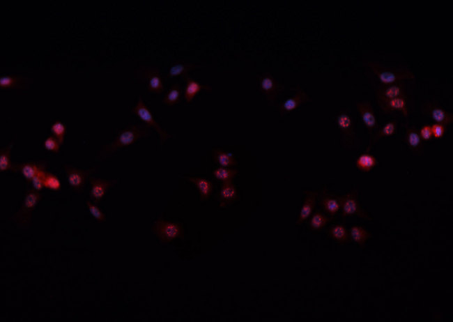 TP63 / p63 Antibody - Staining HeLa cells by IF/ICC. The samples were fixed with PFA and permeabilized in 0.1% Triton X-100, then blocked in 10% serum for 45 min at 25°C. The primary antibody was diluted at 1:200 and incubated with the sample for 1 hour at 37°C. An Alexa Fluor 594 conjugated goat anti-rabbit IgG (H+L) Ab, diluted at 1/600, was used as the secondary antibody.