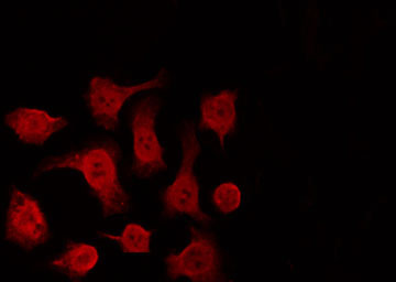 TP63 / p63 Antibody