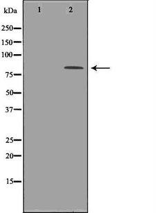 TP63 / p63 Antibody - Western blot analysis of COS7 cell lysates using TP63 antibody. The lane on the left is treated with the antigen-specific peptide.