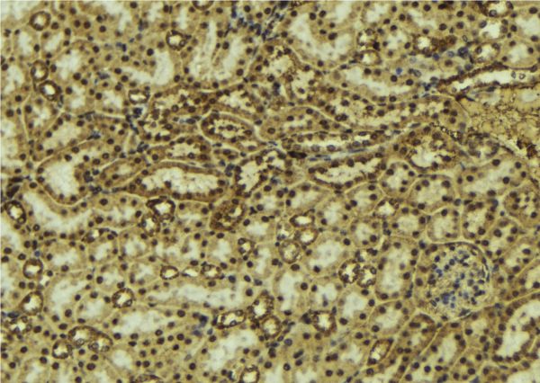 TP63 / p63 Antibody - 1:100 staining mouse kidney tissue by IHC-P. The sample was formaldehyde fixed and a heat mediated antigen retrieval step in citrate buffer was performed. The sample was then blocked and incubated with the antibody for 1.5 hours at 22°C. An HRP conjugated goat anti-rabbit antibody was used as the secondary.