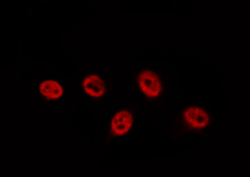 TP63 / p63 Antibody - Staining HeLa cells by IF/ICC. The samples were fixed with PFA and permeabilized in 0.1% Triton X-100, then blocked in 10% serum for 45 min at 25°C. The primary antibody was diluted at 1:200 and incubated with the sample for 1 hour at 37°C. An Alexa Fluor 594 conjugated goat anti-rabbit IgG (H+L) antibody, diluted at 1/600, was used as secondary antibody.