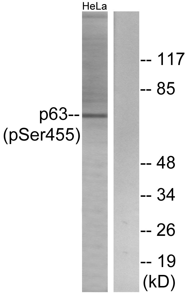 TP63 / p63 Antibody - Western blot analysis of lysates from HeLa cells treated with TNF 2500U/ML 30', using p63 (Phospho-Ser455) Antibody. The lane on the right is blocked with the phospho peptide.