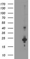 TP73-AS1 / KIAA0495 Antibody - HEK293T cells were transfected with the pCMV6-ENTRY control. (Left lane) or pCMV6-ENTRY KIAA0495. (Right lane) cDNA for 48 hrs and lysed
