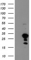 TP73-AS1 / KIAA0495 Antibody - HEK293T cells were transfected with the pCMV6-ENTRY control. (Left lane) or pCMV6-ENTRY KIAA0495. (Right lane) cDNA for 48 hrs and lysed