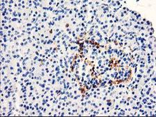 TP73-AS1 / KIAA0495 Antibody - Immunohistochemical staining of paraffin-embedded Human pancreas tissue within the normal limits using anti-KIAA0495 mouse monoclonal antibody. (Heat-induced epitope retrieval by 10mM citric buffer, pH6.0, 100C for 10min,